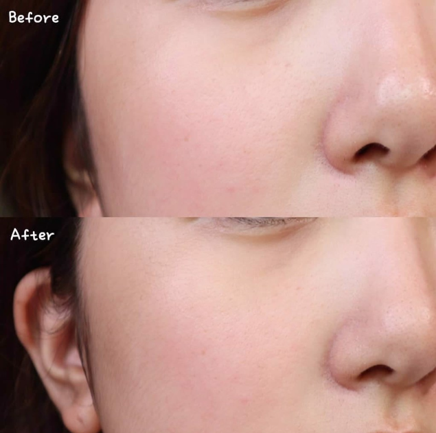 Tinh Chất Tẩy Tế Bào Chết The Ordinary AHA 30% BHA 2% Peeling Solution