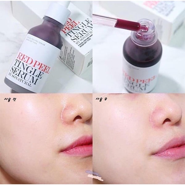 So Natural Red Peel Tingle Serum