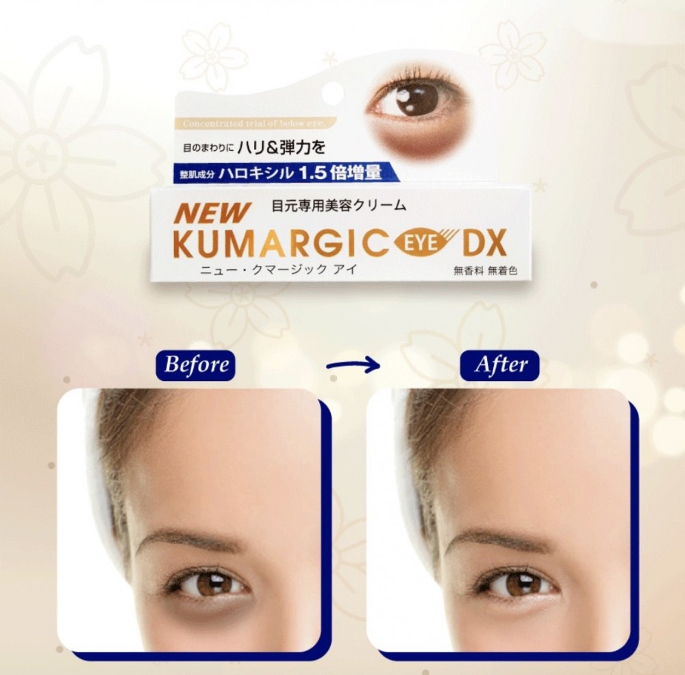 Kem dưỡng mắt Kumargic eye Dx nhật bản 20g
