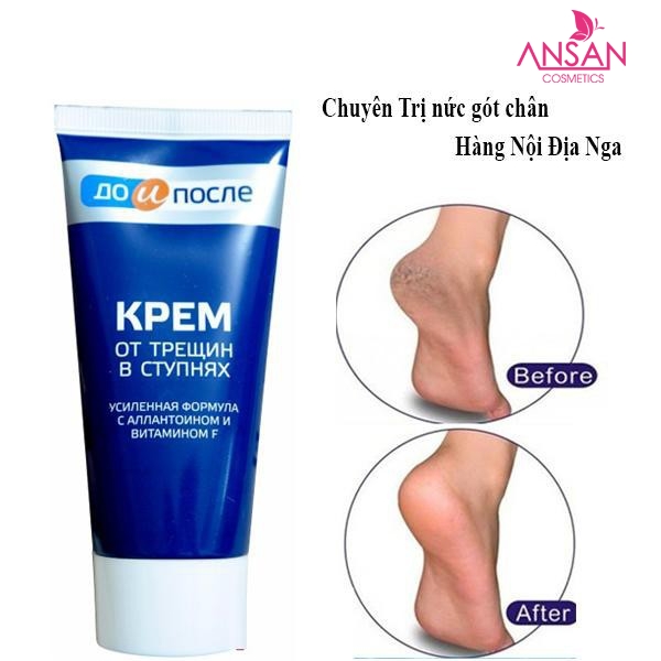 Kem Trị Nứt Gót Chân Kpem Apteka Của Nga 50ml - Giá cực rẻ!